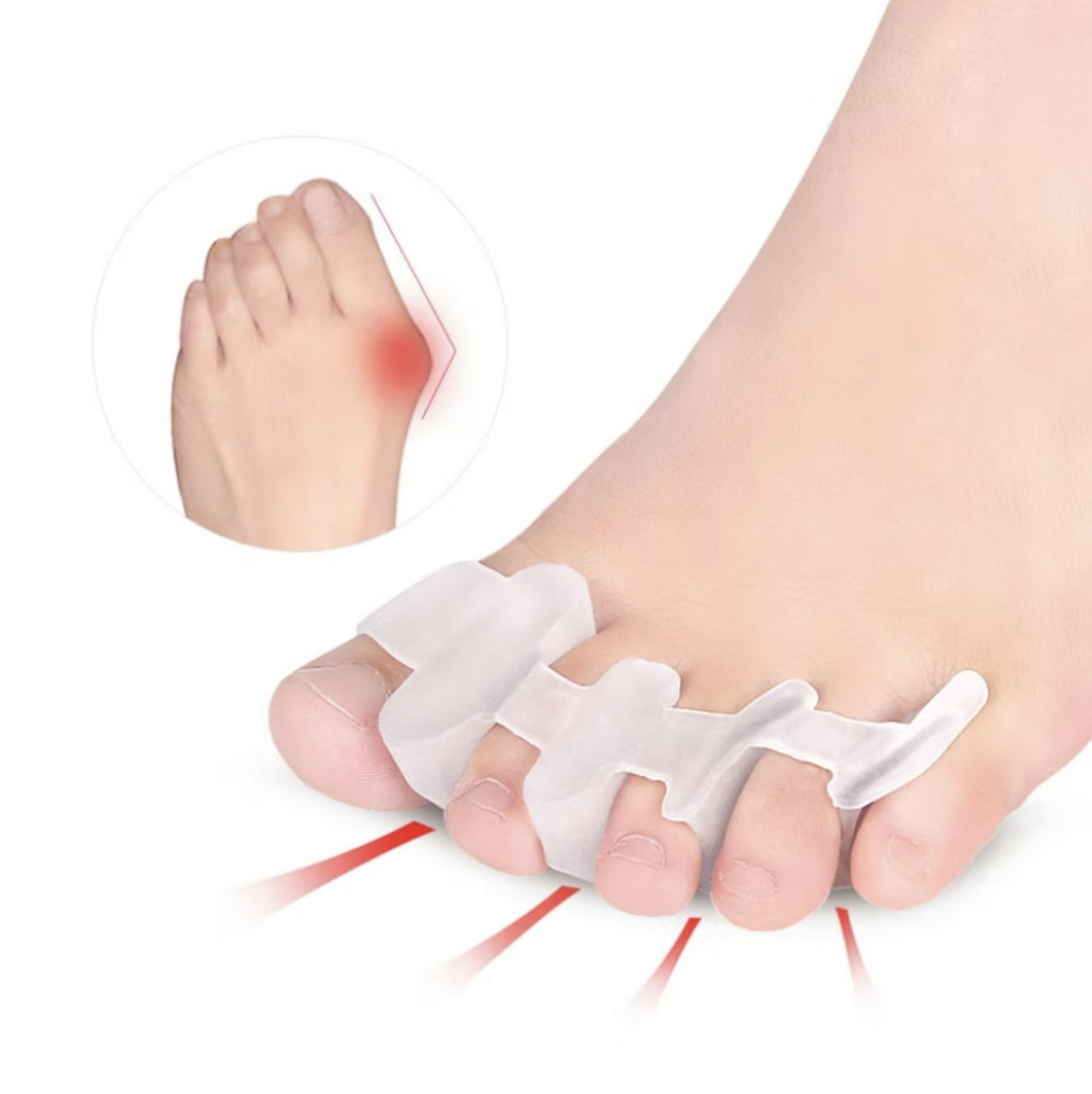 Hallux valgus tåspridare (stort avstånd, 2st)