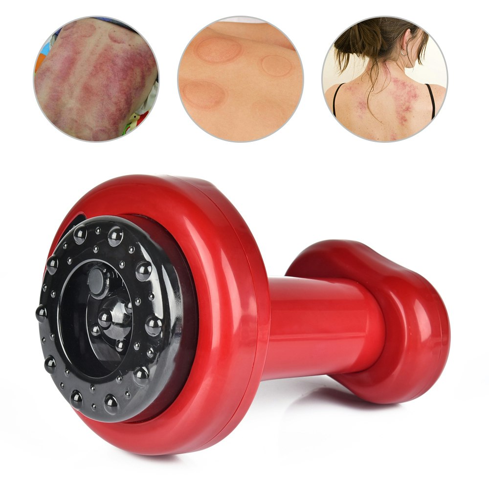ThermoCupp – Elektrisk Koppning och Gua Sha Terapi