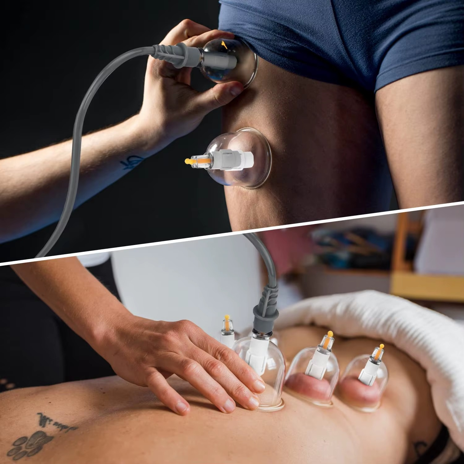 Koppningskit med Sugkoppor – Mot Smärta, Spänningar & Celluliter