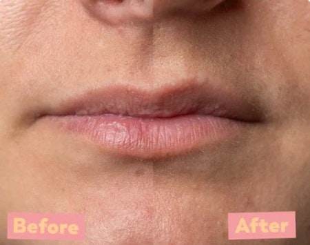Peel Lip TREW