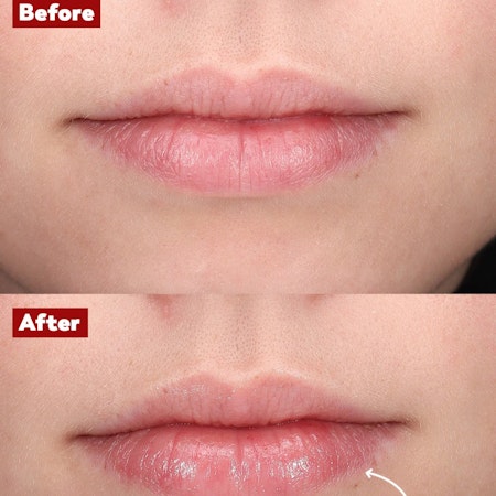 Plump Lip TREW
