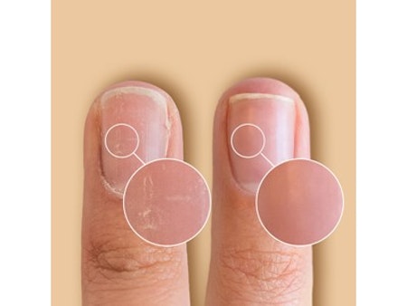 SolarOil Nail Care 7,38 ml