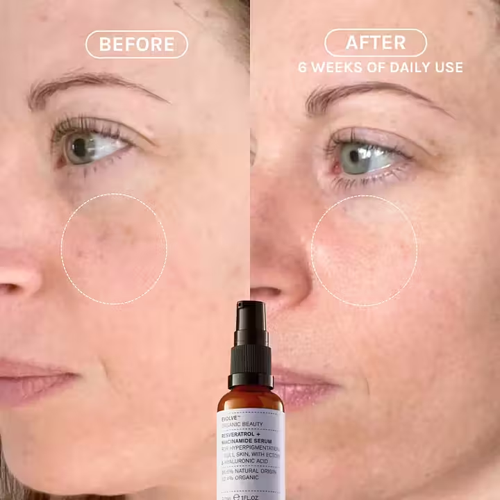 Evolve Resveratrol + Niacinamide Serum – økologisk serum som reduserer pigmentering, gir jevn hudtone og beskytter mot miljøskader.