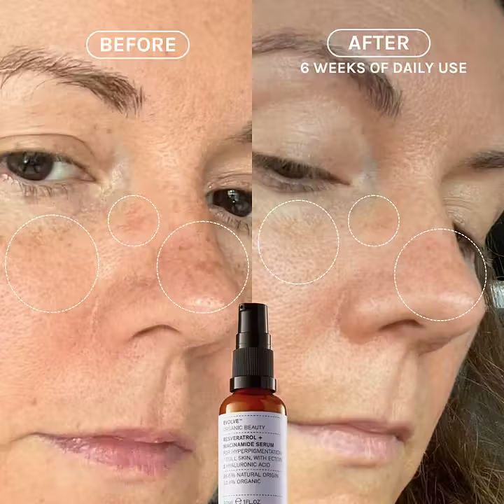 Evolve Resveratrol + Niacinamide Serum – økologisk serum som reduserer pigmentering, gir jevn hudtone og beskytter mot miljøskader.