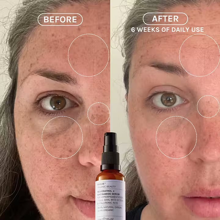 Evolve Resveratrol + Niacinamide Serum – økologisk serum som reduserer pigmentering, gir jevn hudtone og beskytter mot miljøskader.