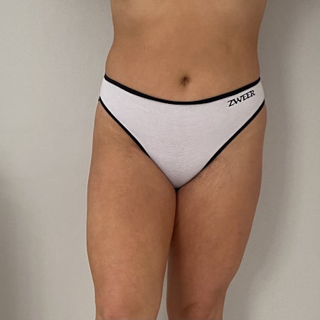 SET | Triangle Topp & Hög Brazilian Trosa