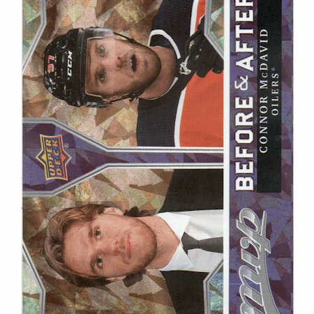2021-22 Upper Deck MVP Before and After Gold #BA2 Connor McDavid (50-X359-OILERS)