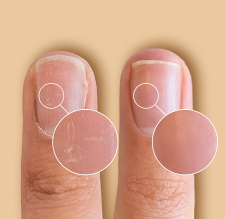 SolarOil Nail and cuticle Care