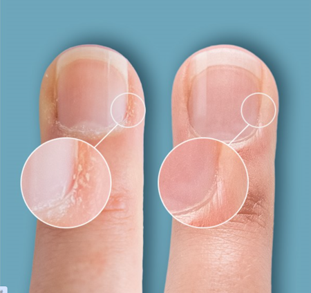 Cuticle Eraser