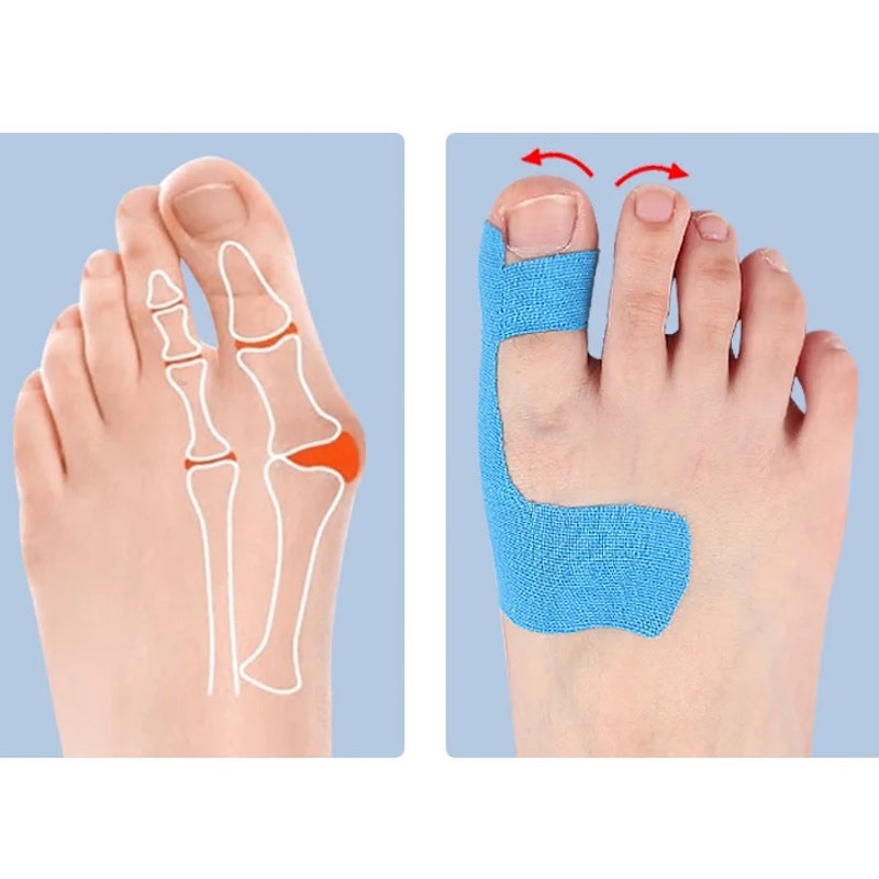 Kinesioteippi hallux valgus 10kpl , valmiiksi leikattu BEIGE