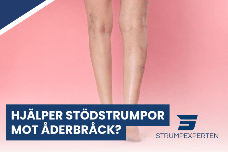 Hjälper stödstrumpor mot åderbråck?