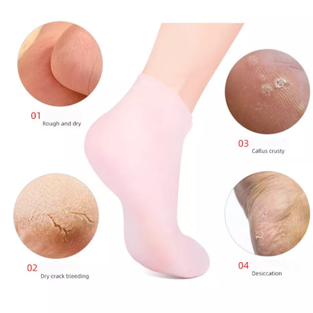 Mjukgörande gelsocka