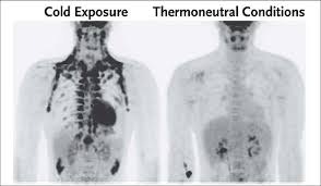Brunt Fett, Cryoterapi och Dopamin: Optimera Din Hälsa och Metabolism